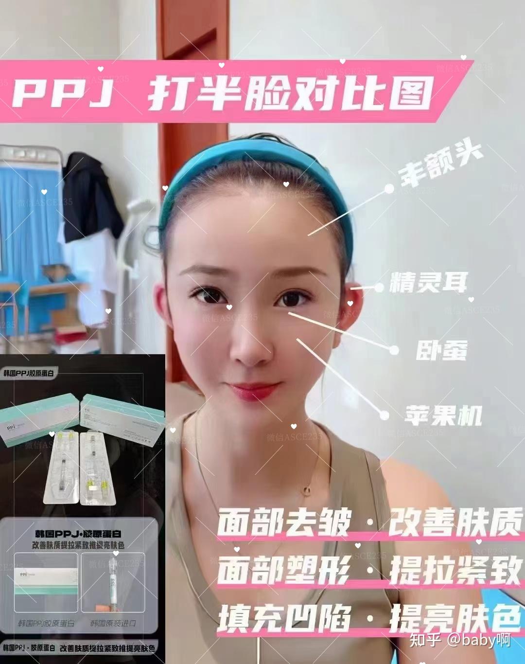 Ppj 100G